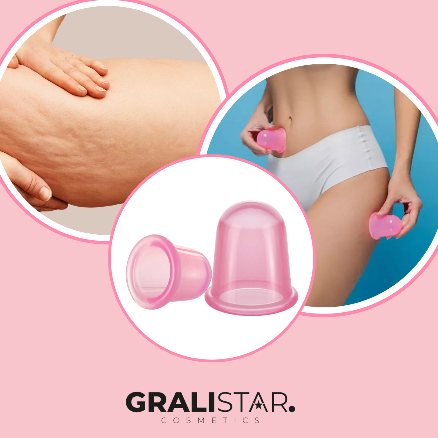 Cup massaggio cellulite